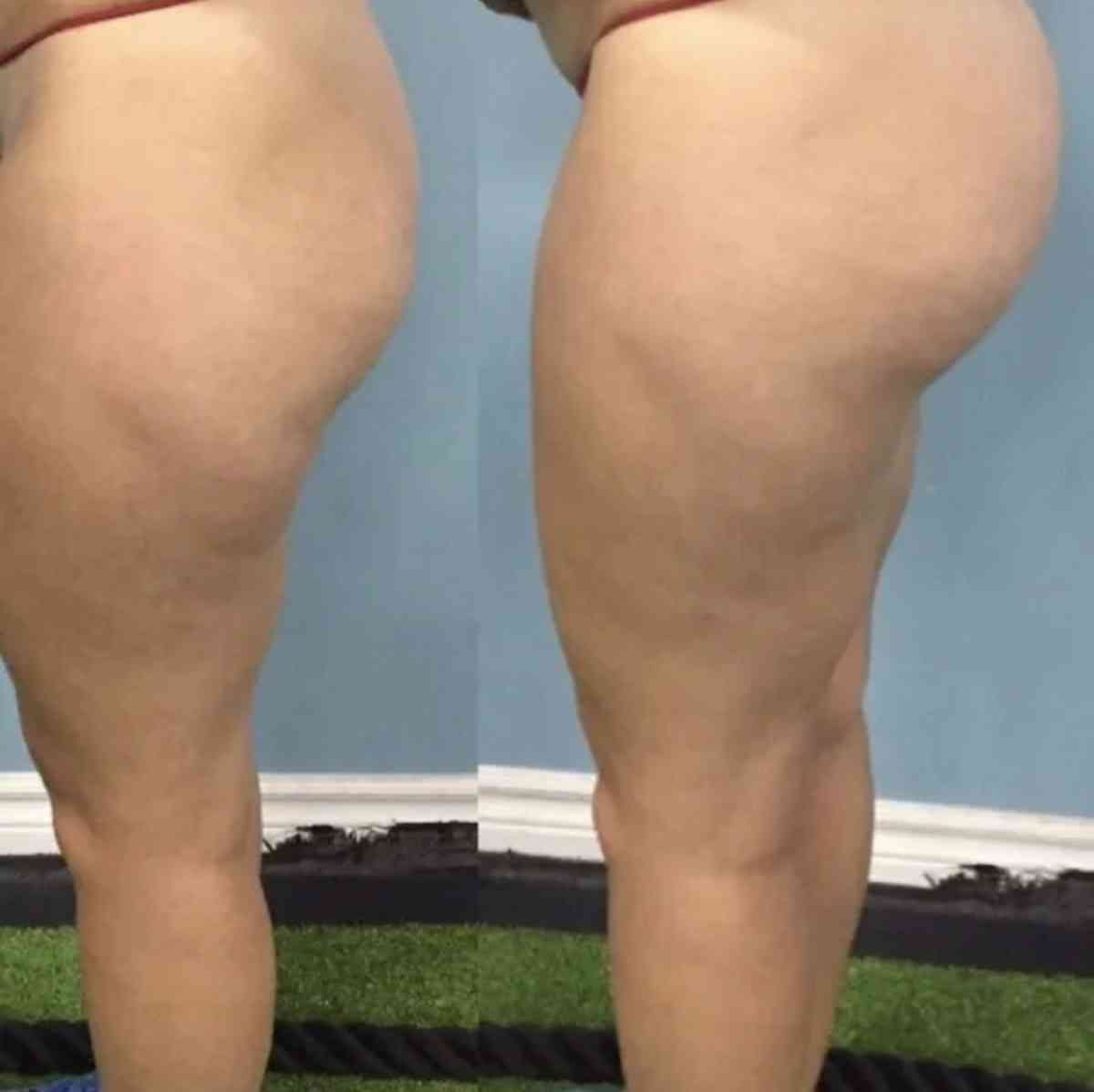 Brazilian butt oil - Acworth, Georgia - FleaMarketBay