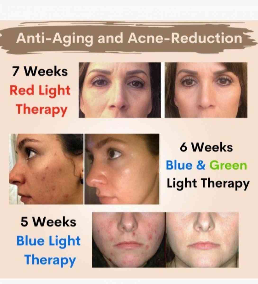 VogueNow Dermawave Photon Mask - Salt Lake City, Utah - FleaMarketBay