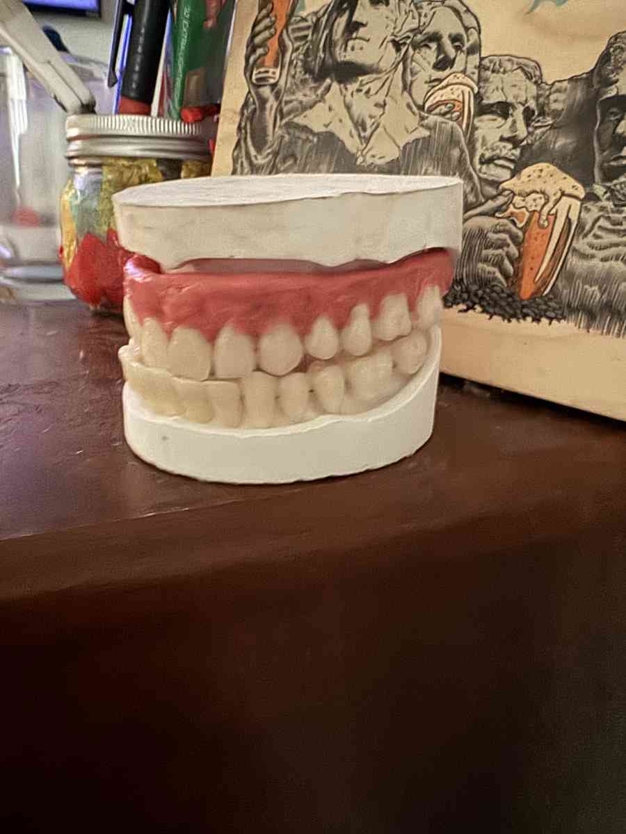 Unused Custom Designed Universal Unisex Dentures - Bridgewater, New Jersey - FleaMarketBay