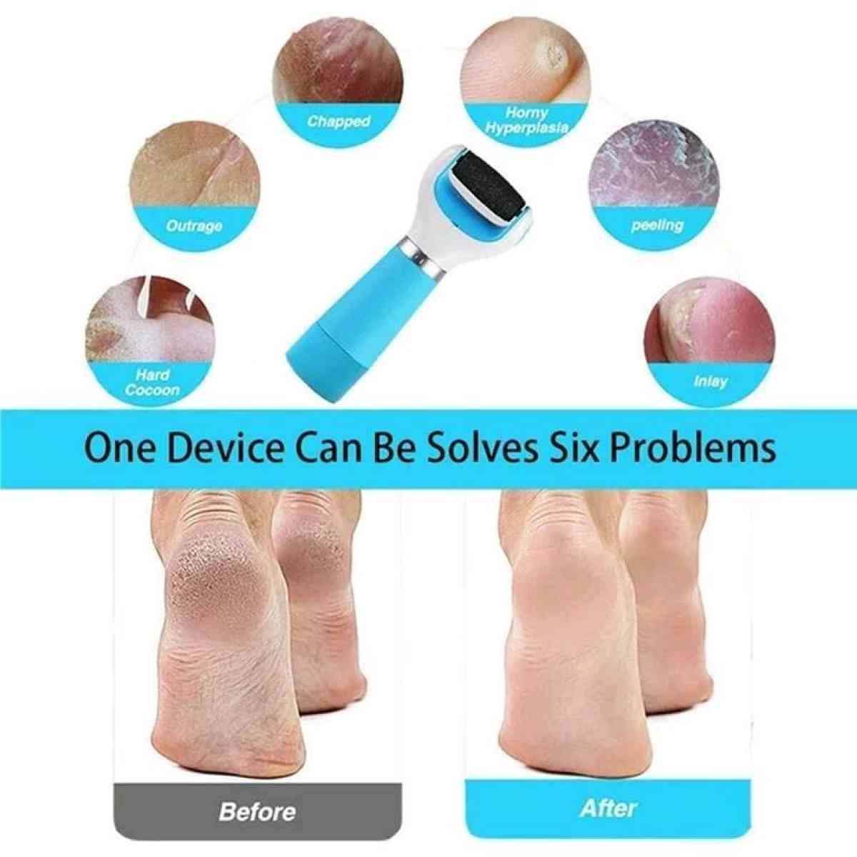 Electronic Foot File Roller Callus Remover USB Cable Include - Columbus, Ohio - FleaMarketBay