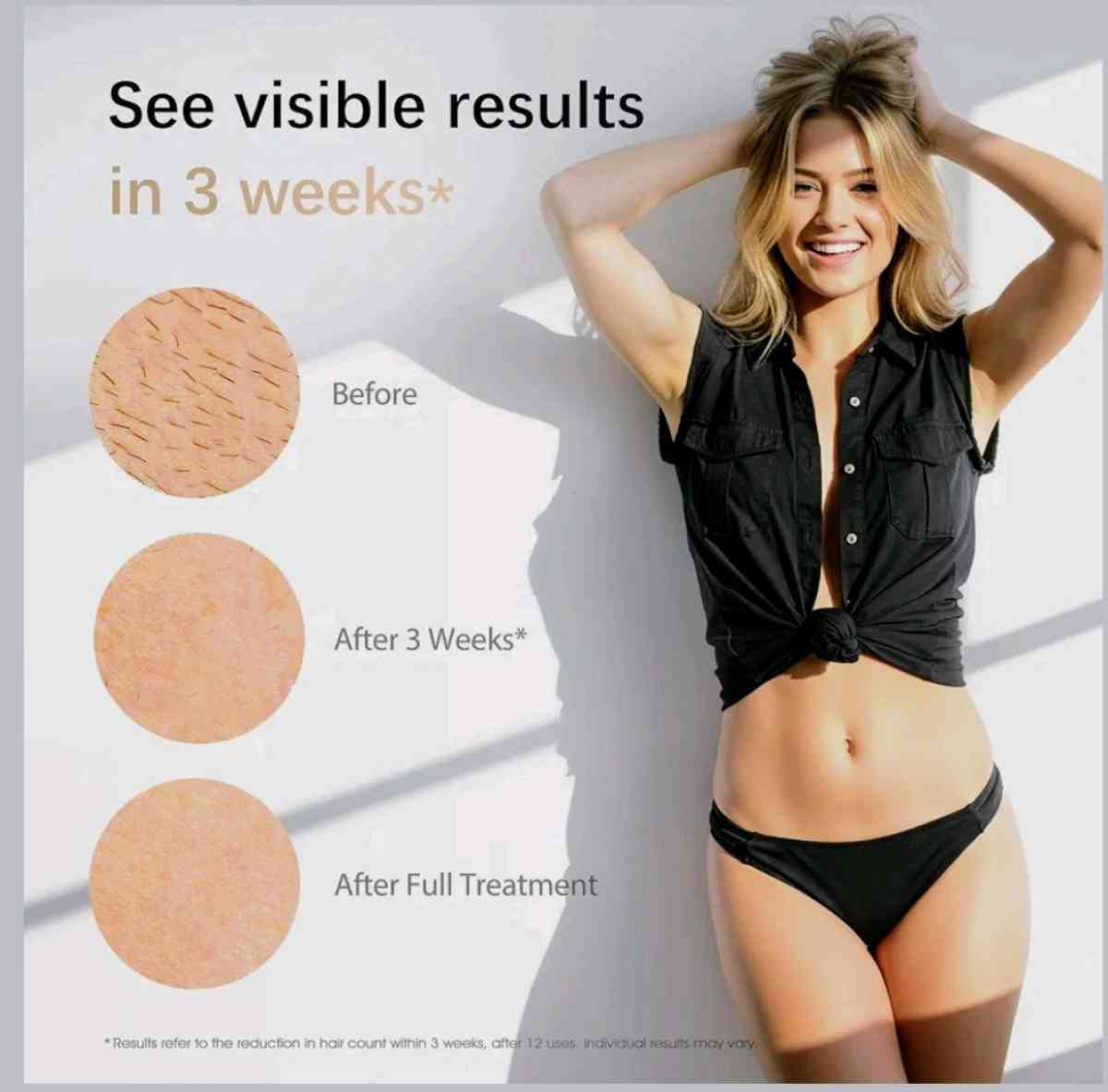 Depiladora Lser - Richmond, Texas - FleaMarketBay