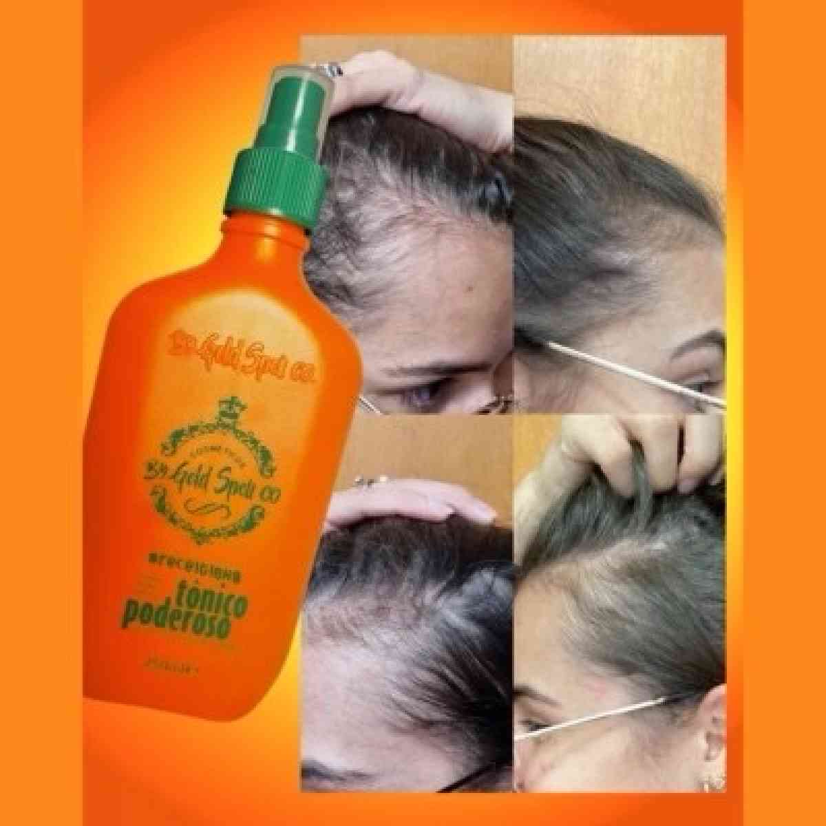 Gold Spell Receitinha Poderosa Hair Tonic 250ml  Original fr - Boca Raton, Florida