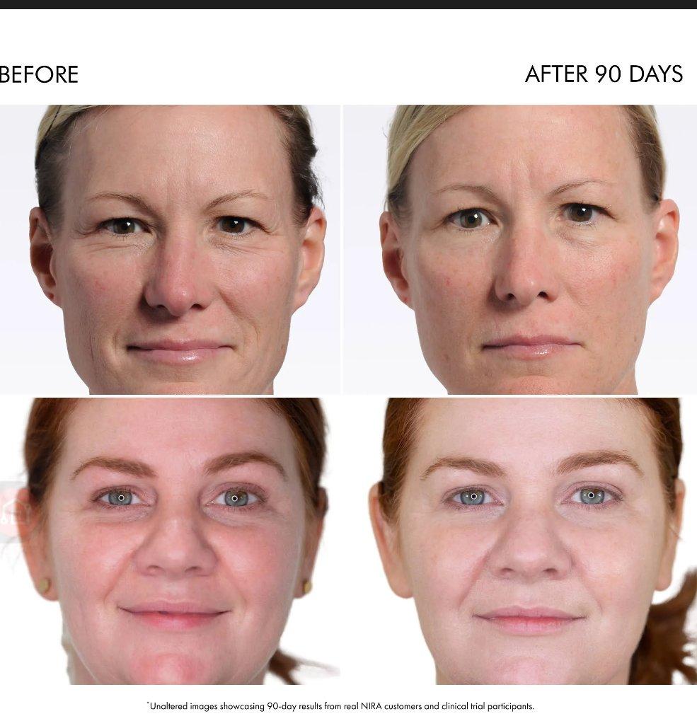 NIRA PRO ANTi AGING LASER - San Francisco, California - FleaMarketBay